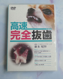 高速完全抜歯　DVD